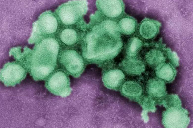 流感病毒悄然转变，甲型H1N1来了, 新风系统可以预防流感吗？